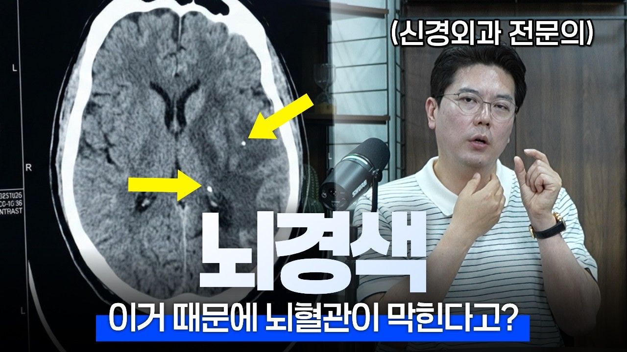 뇌경색, 가장 흔한 뇌졸중의 원인