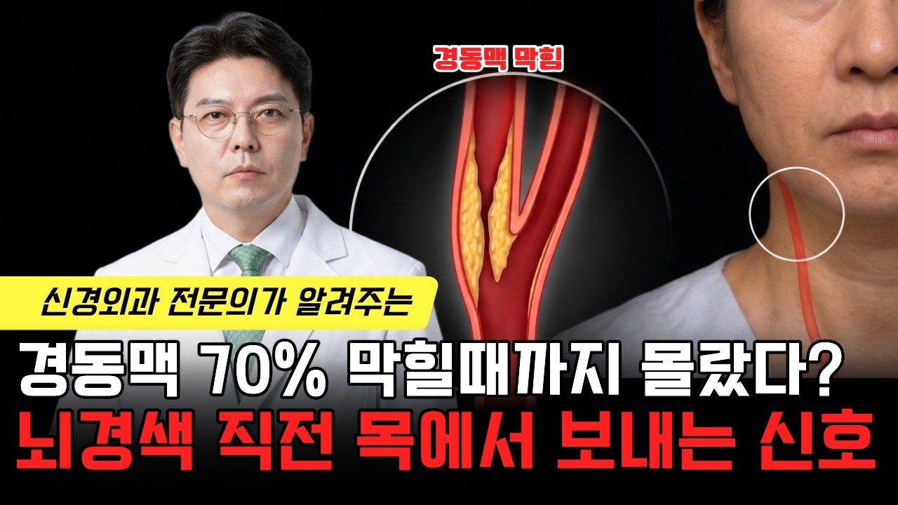 경동맥 협착증, 약물치료와 관리가 중요한 이유