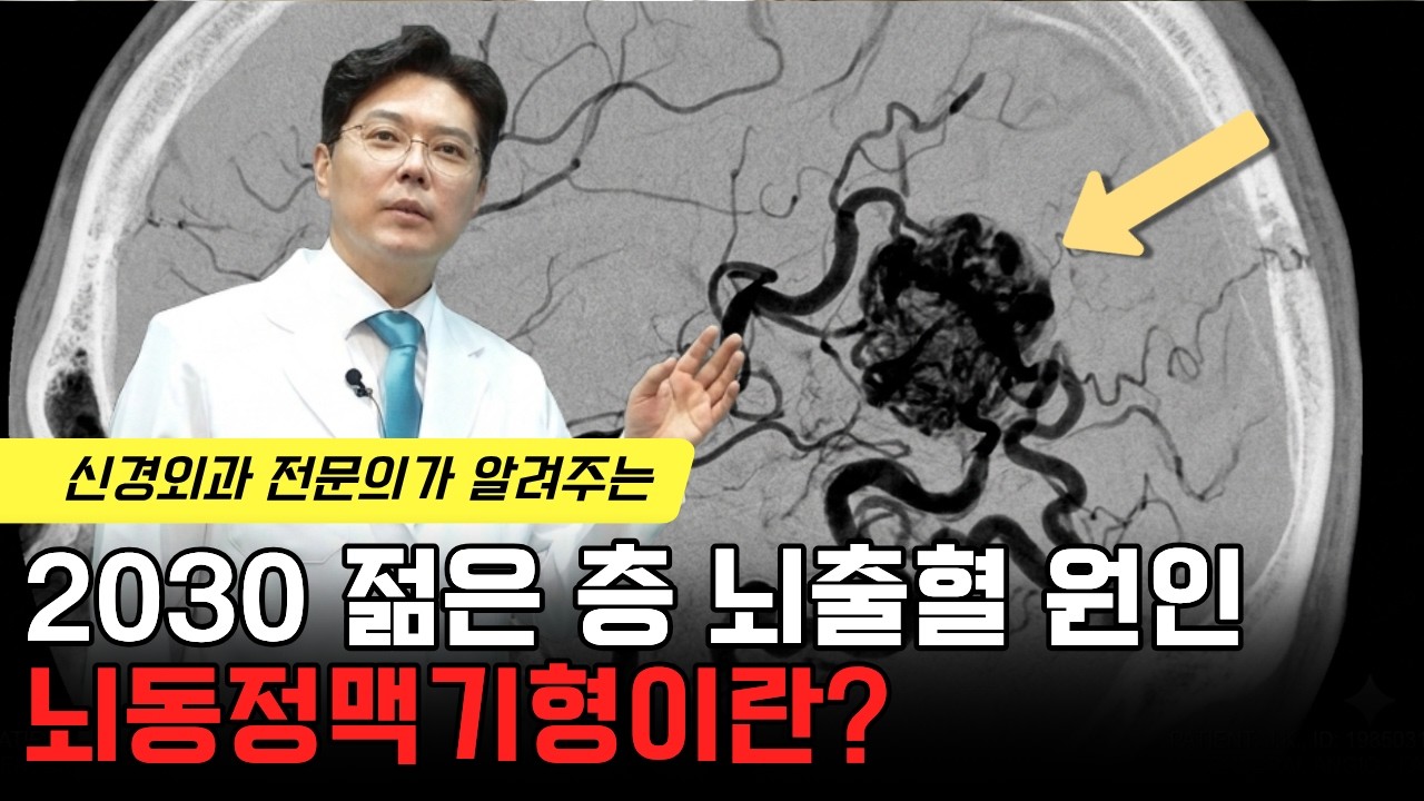 젊은 나이에 발생한 뇌출혈, 뇌동정맥기형도 확인합니다