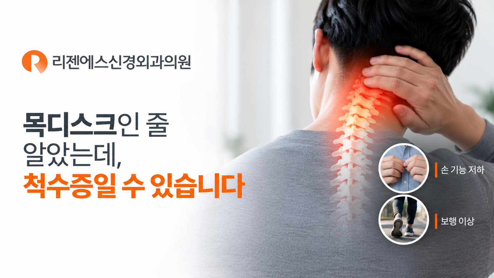목디스크인 줄 알았는데, 척수증일 수 있습니다