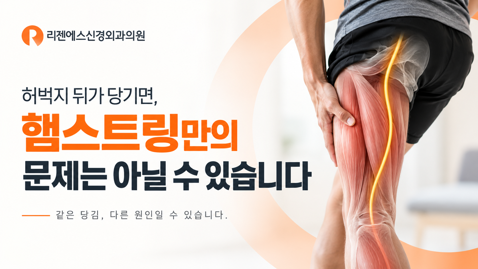허벅지 뒤가 당기면, 햄스트링만의 문제는 아닐 수 있습니다